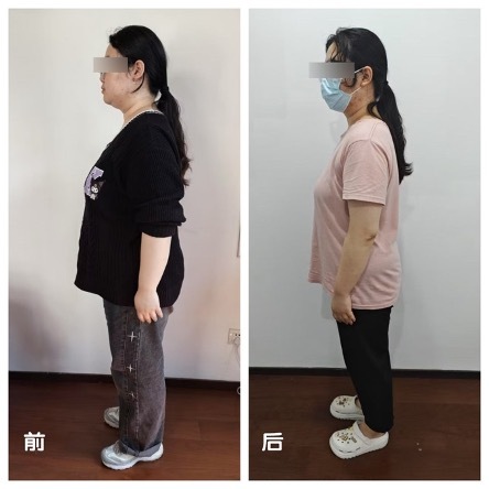 减重, 心功能不全